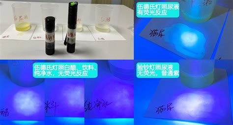 伍德氏燈和紫外線燈一樣嗎(伍德氏燈和紫外線燈是一回事嗎)縮略圖