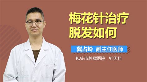 梅花針治療脫發使用方法,梅花針治療脫發使用方法視頻教程縮略圖