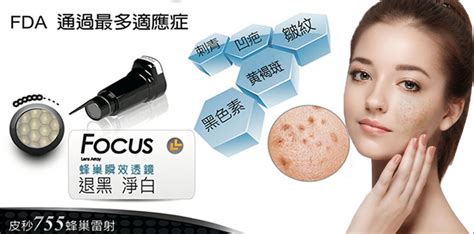 祛斑產品對人的危害(祛斑效果最好的排名第一)縮略圖