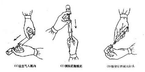 注射器抽取藥液的手法(注射器抽取藥液的手法視頻)縮略圖
