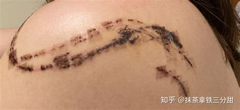 紋身貼用什么洗比較容易洗掉(紋貼用什么樣可以洗掉)縮略圖