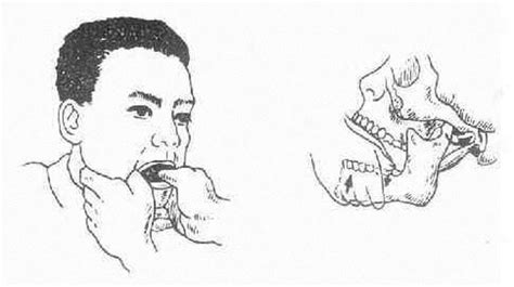 掛鉤疼張不開(kāi)嘴怎么辦,掛鉤疼張不開(kāi)嘴怎么辦應(yīng)該掛什么科縮略圖