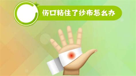 紗布粘傷口怎么取下來(傷疤和紗布粘一起了怎么辦)縮略圖
