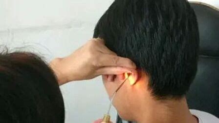 耳釘后面的塞子取不掉怎么辦(耳釘后面的塞子取不掉怎么辦視頻)縮略圖