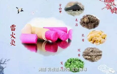 雷火灸最早出現(xiàn)在什么時(shí)候,雷火灸標(biāo)準(zhǔn)及注意事項(xiàng)縮略圖
